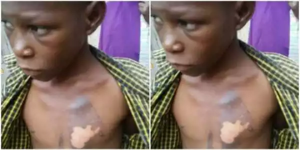 Boy assaulted with hot iron by Aunt in Kano State (photos)